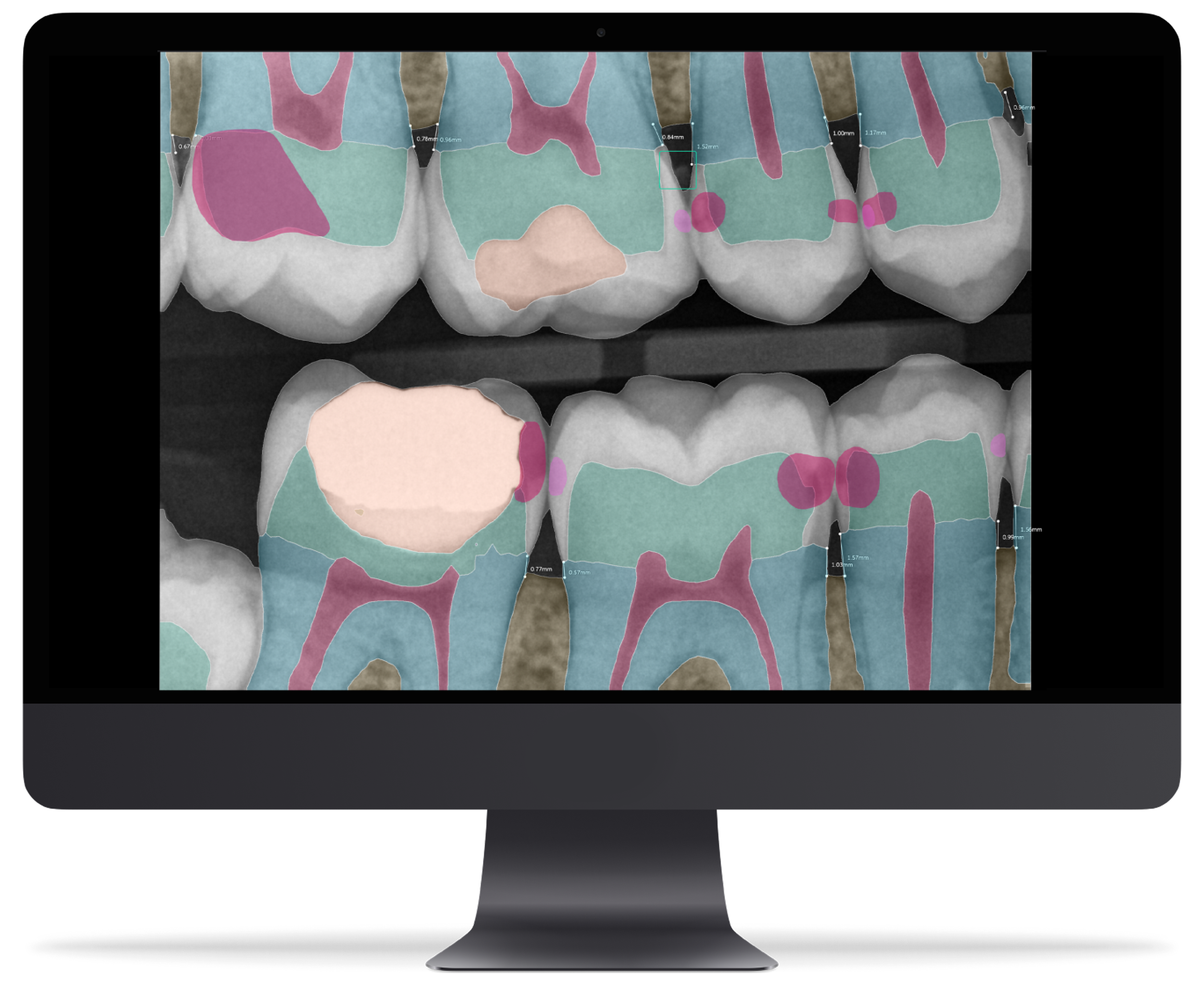 Native Dental Imaging on iPad