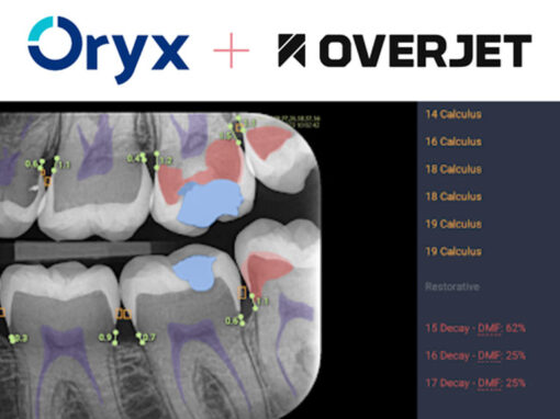 Image of Overjet AI X-Ray of teeth