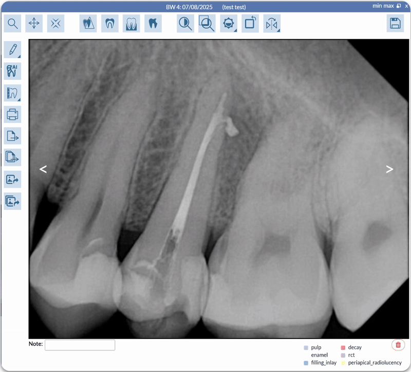 Native Dental Imaging on iPad