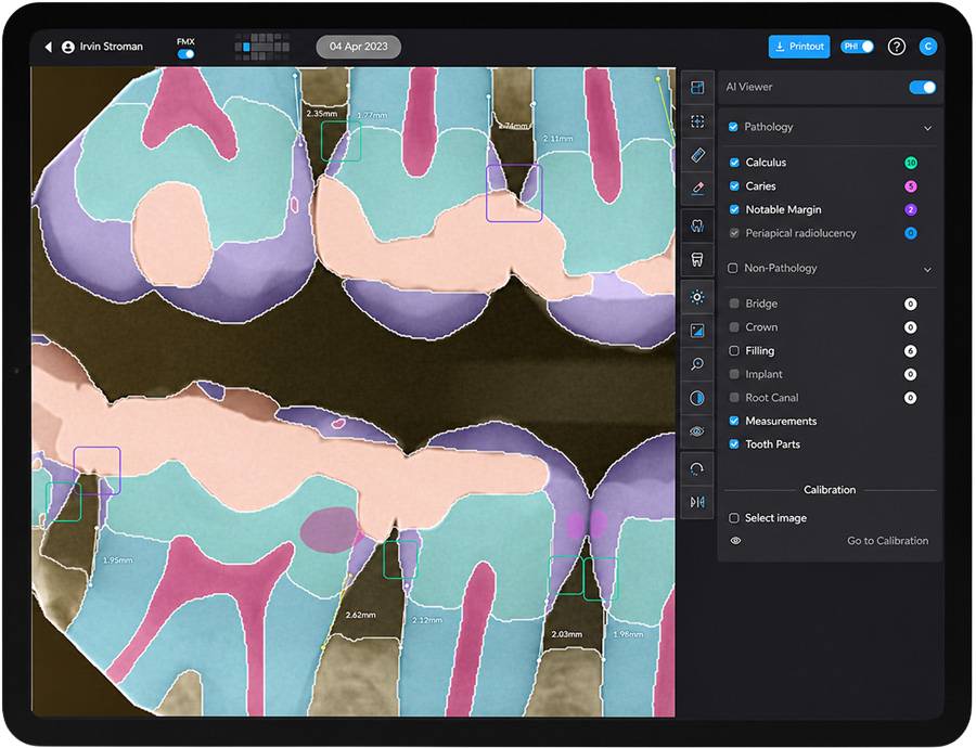 Native Dental Imaging on iPad