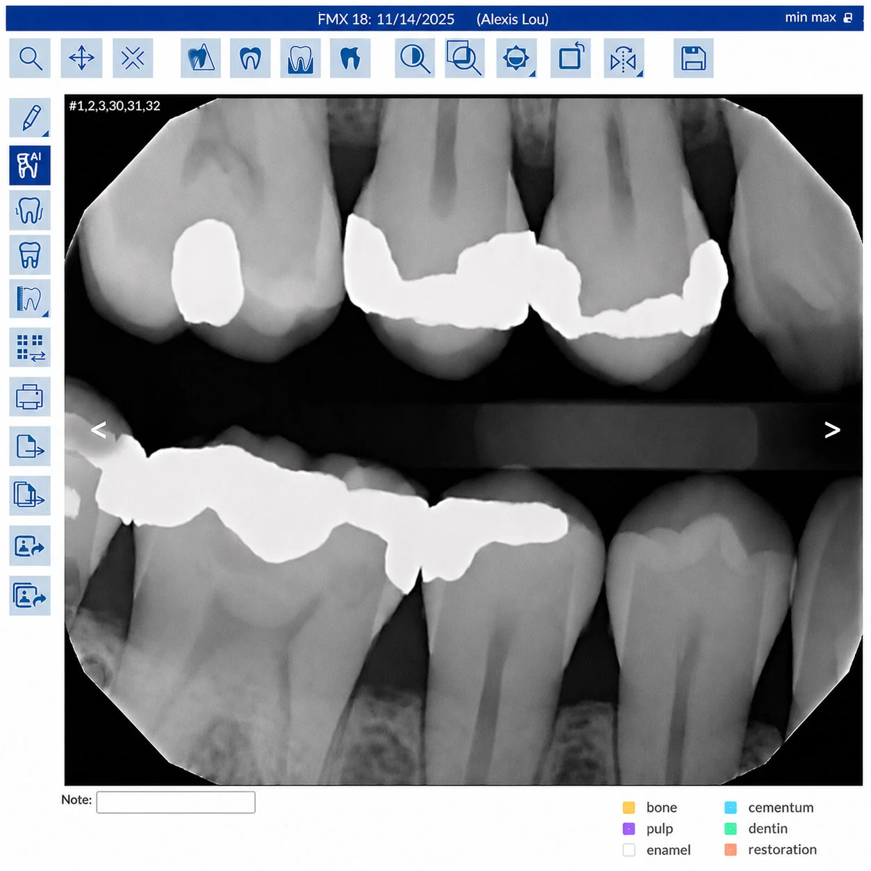 Dental radiograph in Oryx imaging with AI analysis